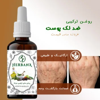 بطری روغن تخصصی ضد لک و جوش هربانا